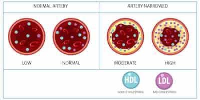 Free vector types of cholesterol hdl and ldl