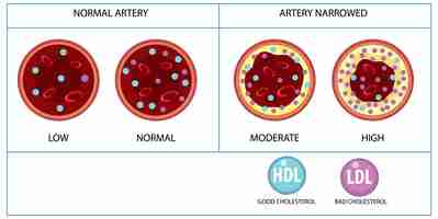 Free vector types of cholesterol hdl and ldl