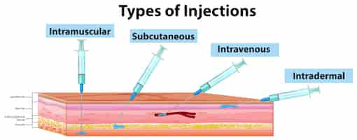 Free vector types of injections diagram