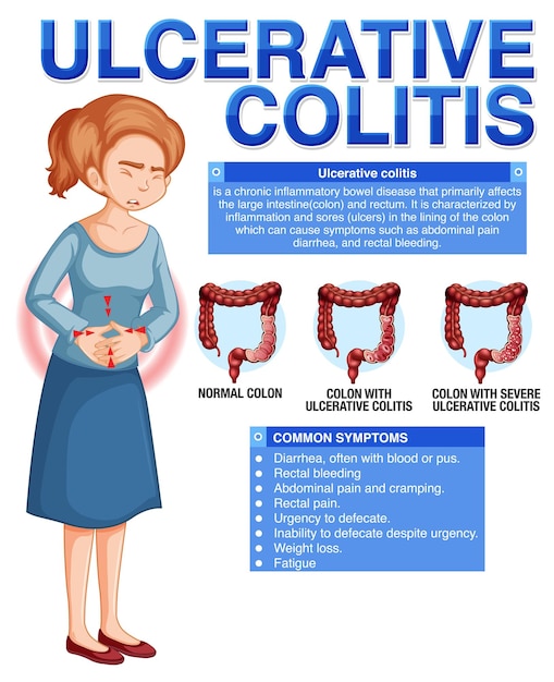 Free vector ulcerative colitis symptoms infographic