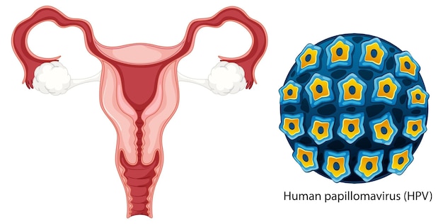 Concetto di batteri di infezione vaginale