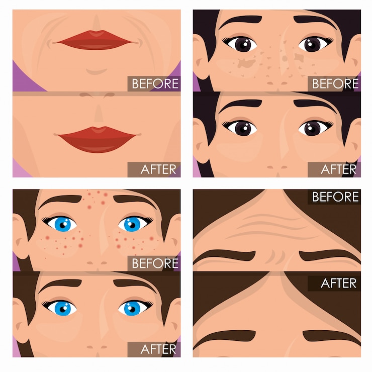Free Vector woman before and after skin treatment