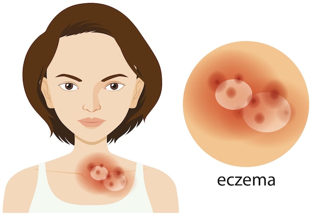 Free vector woman and eczema problem