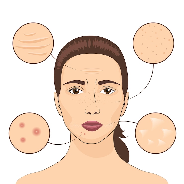Free Vector woman skin problem vector illustration