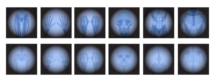 Free Vector x ray radiology set healthcare treatment for internal oragns and bones