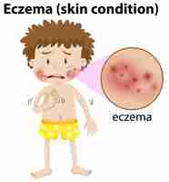 Free vector a young boy having eczema