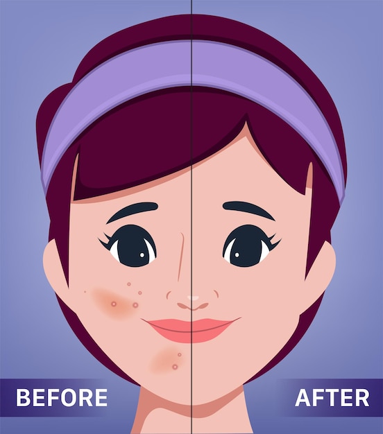 Vettore gratuito il giovane volto femminile acne e pelle pulita il ritratto della clinica chirurgica di una bella donna