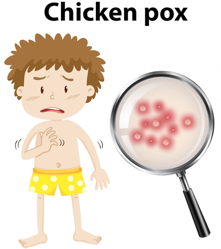 Free Vector a young kid with chicken pox
