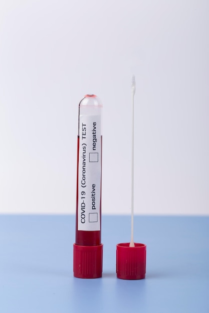 Arrangement d'échantillon de sang de coronavirus en laboratoire