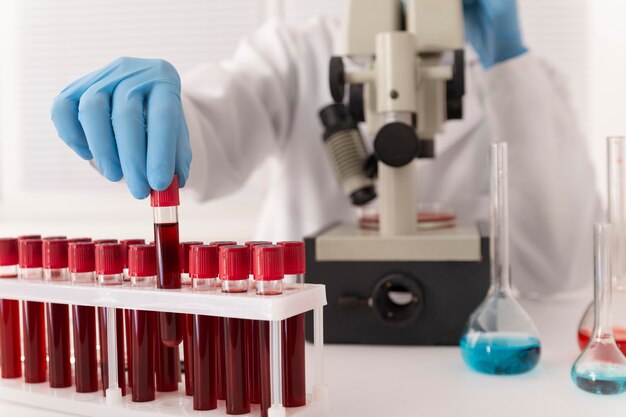 Arrangement d'échantillons de sang de coronavirus en laboratoire