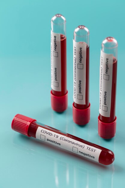 Arrangement d'échantillons de sang de coronavirus en laboratoire