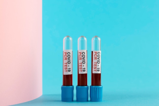 Photo gratuite arrangement de tests pcr de coronavirus