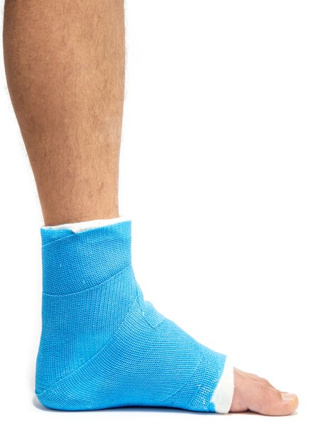 Attelle de cheville bleue. Jambe bandée moulée sur patient de sexe masculin sur fond blanc isolé. Concept de blessure sportive.