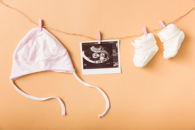 Bonnet de bébé; image échographique et paire de chaussures en laine suspendus sur une corde à linge sur un fond orange