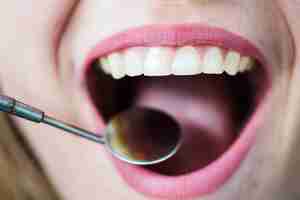 Photo gratuite bouche ouverte de femme avec miroir dentiste