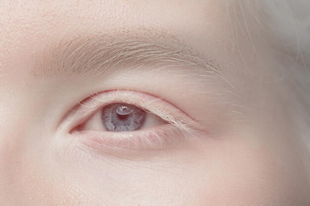 Bouchent le portrait de la belle femme albinos