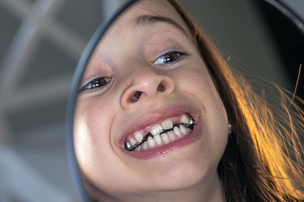 Photo gratuite caucasian preteen girl avec des accolades sur ses dents en regardant le miroir