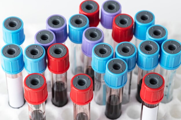 Échantillons de sang dans un support de tubes à essai