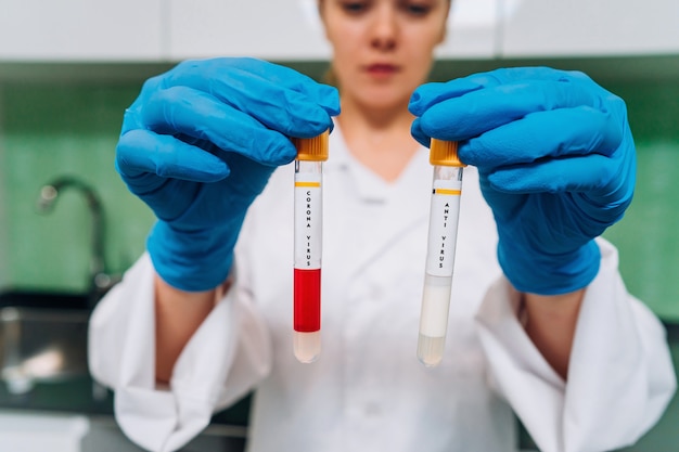 Photo gratuite chercheur médical ou scientifique féminin tient dans les mains un tube à essai