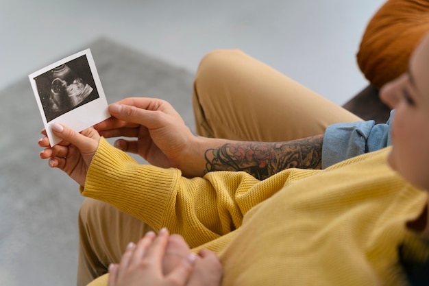 Photo gratuite couple à angle élevé attendant bébé