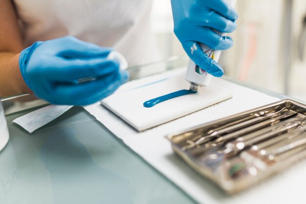 Dentiste mâle utilisant un matériau d&#39;empreinte en silicone bleu