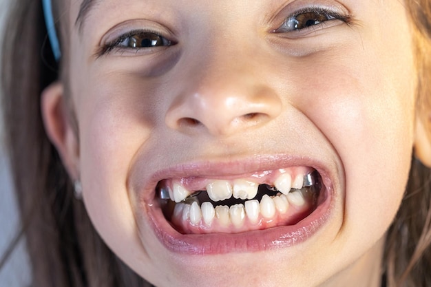 Photo gratuite enfant lors d'une visite chez l'orthodontiste et d'un examen de la cavité buccale