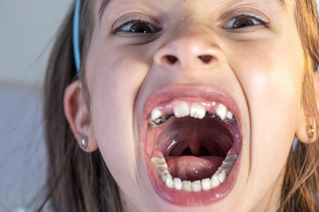 Photo gratuite enfant lors d'une visite chez l'orthodontiste et d'un examen de la cavité buccale