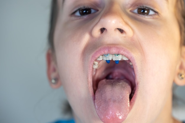 Photo gratuite une enfant ouvre la bouche et montre sa langue.