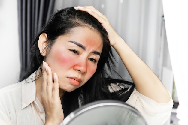 Femme asiatique ayant un problème de coup de soleil sur le visage