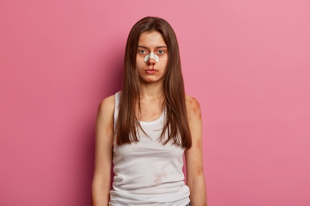 Femme avec des ecchymoses et le nez cassé, étant gravement blessée