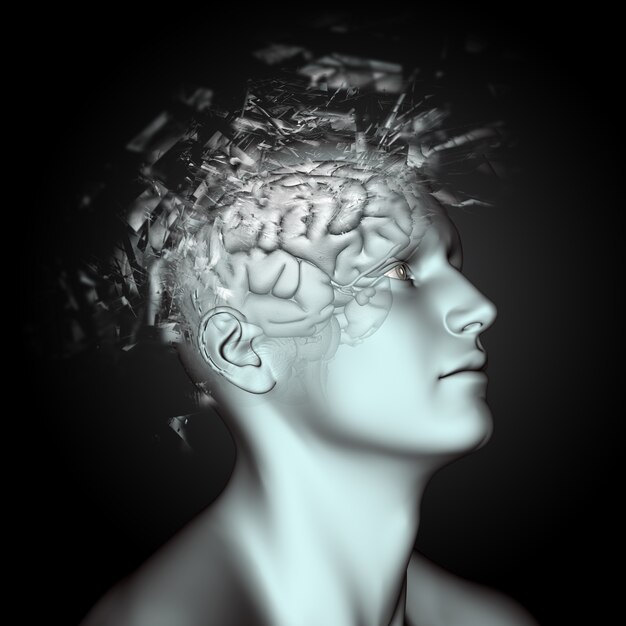 Figure masculine 3D avec effet de bris sur la tête et le cerveau représentant des problèmes de santé mentale