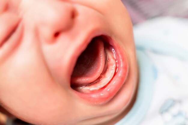 Gros Plan Sur La Bouche De Bebe Age De 3 Mois Qui Pleure Gencives Nues Sans Dents Photo Premium Gros Plan Sur La Bouche De Bebe Age De 3 Mois Qui Pleure Gencives Nues Sans Dents Photo Premium