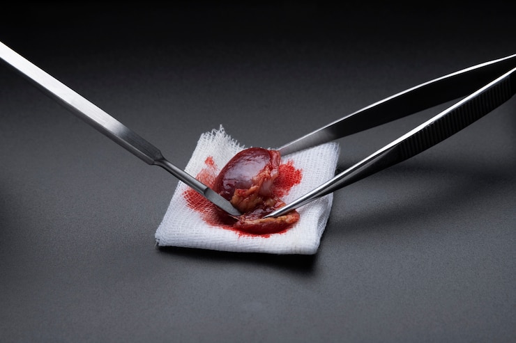 Photo gratuit gros plan sur un scalpel médical métallique et une pince à épiler avec orgue