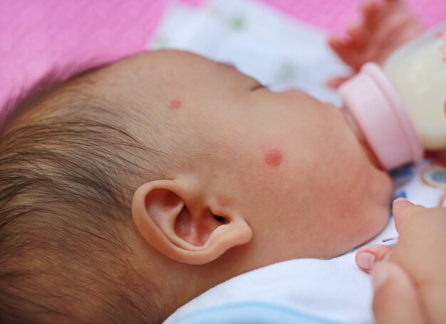 Gros Plan Visage De Bebe Ont Une Piqure De Moustique Photo Premium