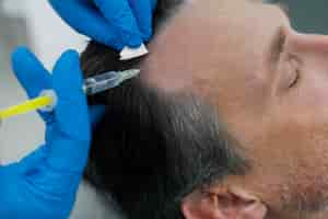 Photo gratuite homme recevant un traitement contre la perte de cheveux