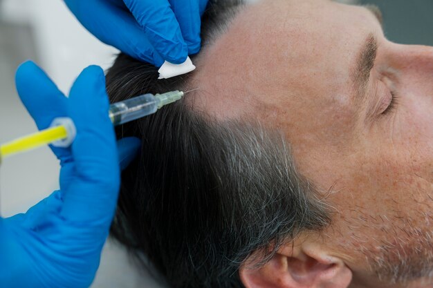 Homme recevant un traitement contre la perte de cheveux