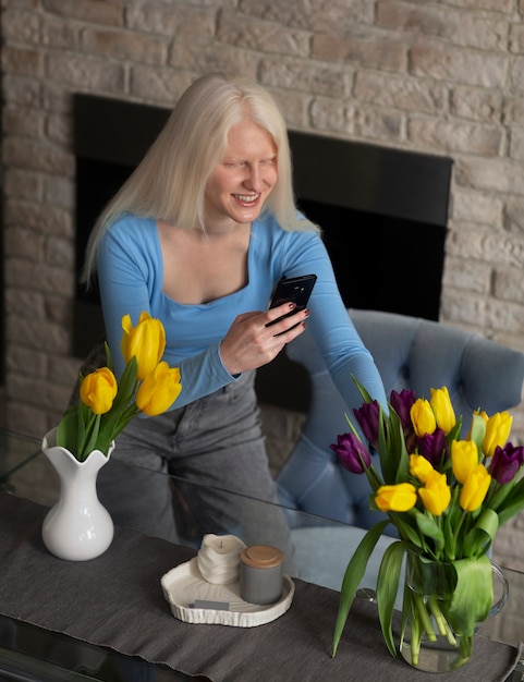 Photo gratuite jeune femme atteinte d'albinisme et de fleurs de tulipes