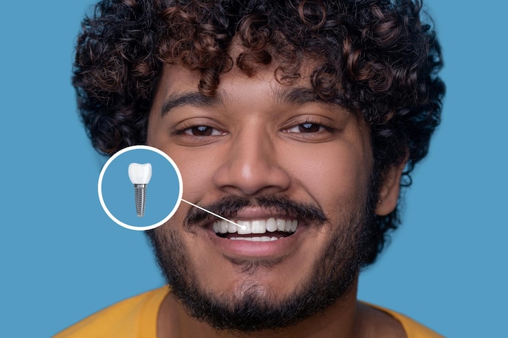 Photo gratuit un jeune homme avec un sourire denté démontre son implant dentaire