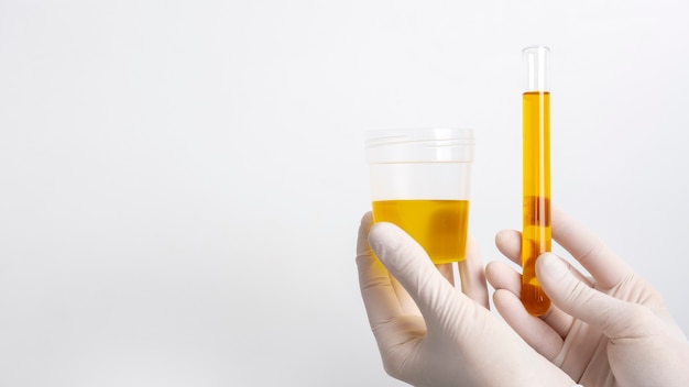 Médecin de laboratoire effectuant un examen médical de l'urine