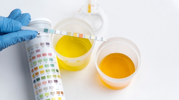 Photo gratuite médecin de laboratoire effectuant un examen médical de l'urine