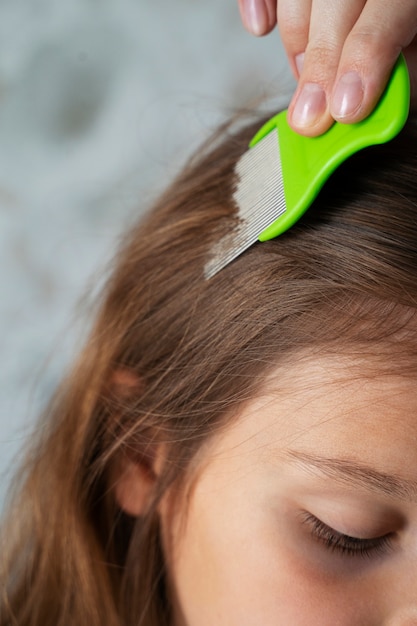 Photo gratuite mère prenant soin de son enfant avec des poux