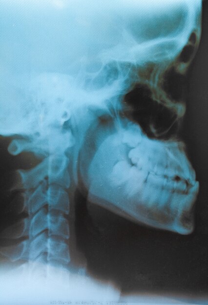 une partie de la santé de la maladie de radiologie squelettique