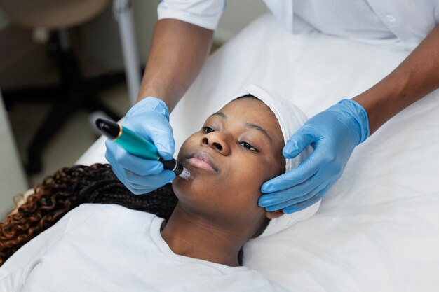 Personne recevant un traitement de beauté par micro-aiguilletage