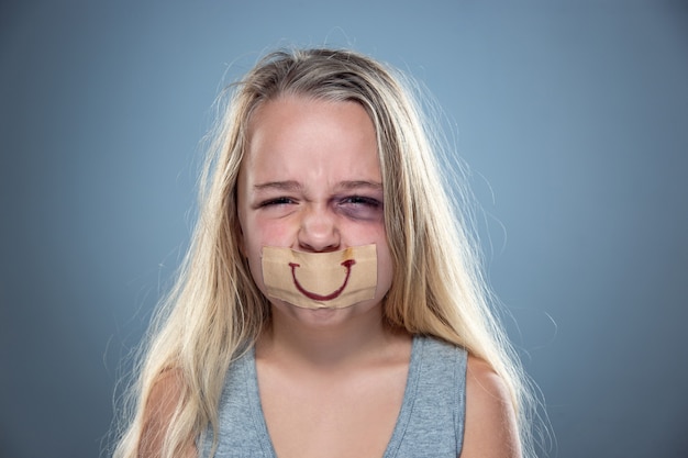 Petite fille triste et effrayée avec des yeux injectés de sang, des bleus et un faux sourire sur la bouche.