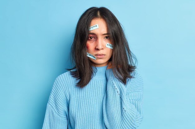 Photo gratuite photo d'une femme maltraitée avec des yeux ensanglantés et une ecchymose blessée par une personne cruelle se bat contre les abus criminels porte un pull décontracté