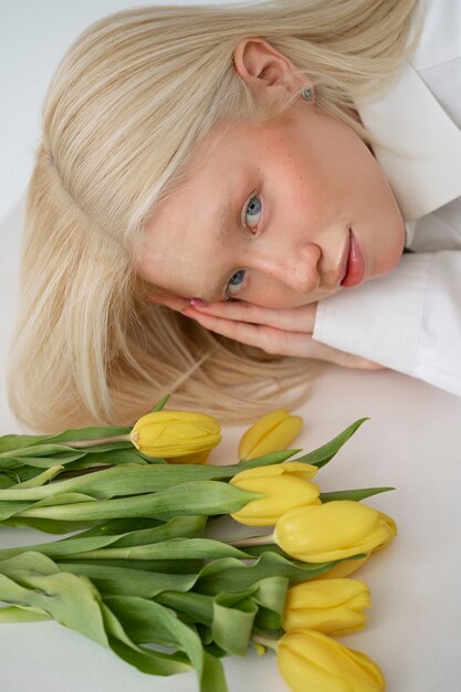 Portrait de belle femme albinos