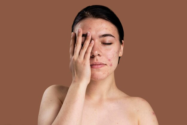 Portrait de jeune femme confiante avec son acné
