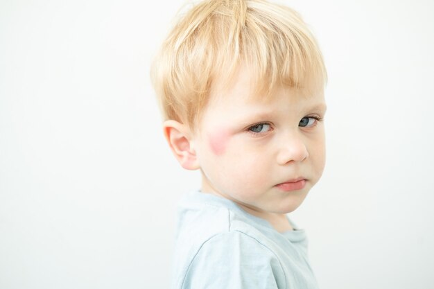 Images Dermatite Enfant Vecteurs Photos Et Psd Gratuits