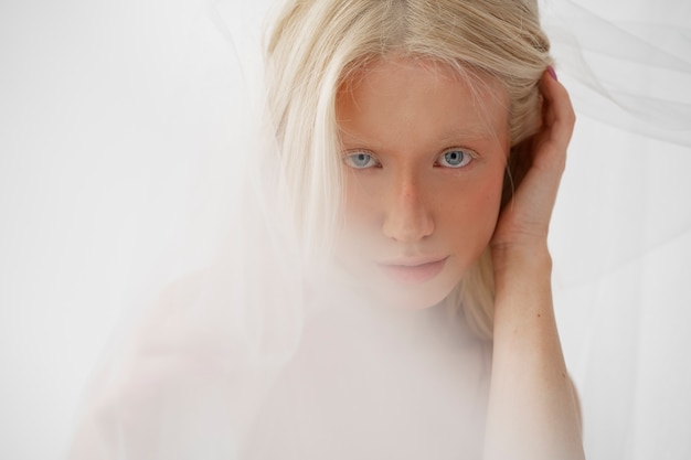 Photo gratuite portrait en studio d'une femme albinos