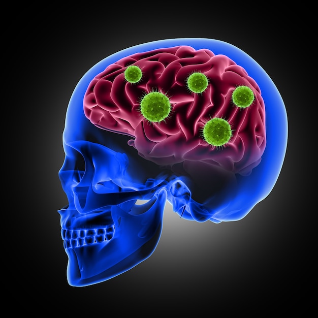 Rendement 3D d&#39;un crâne masculin avec des cellules de virus attaquant le cerveau